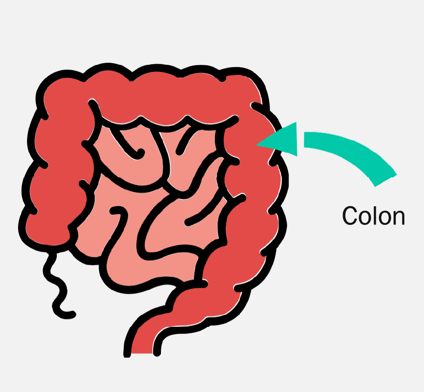 A graphic of intestines with an arrow pointing to the colon.