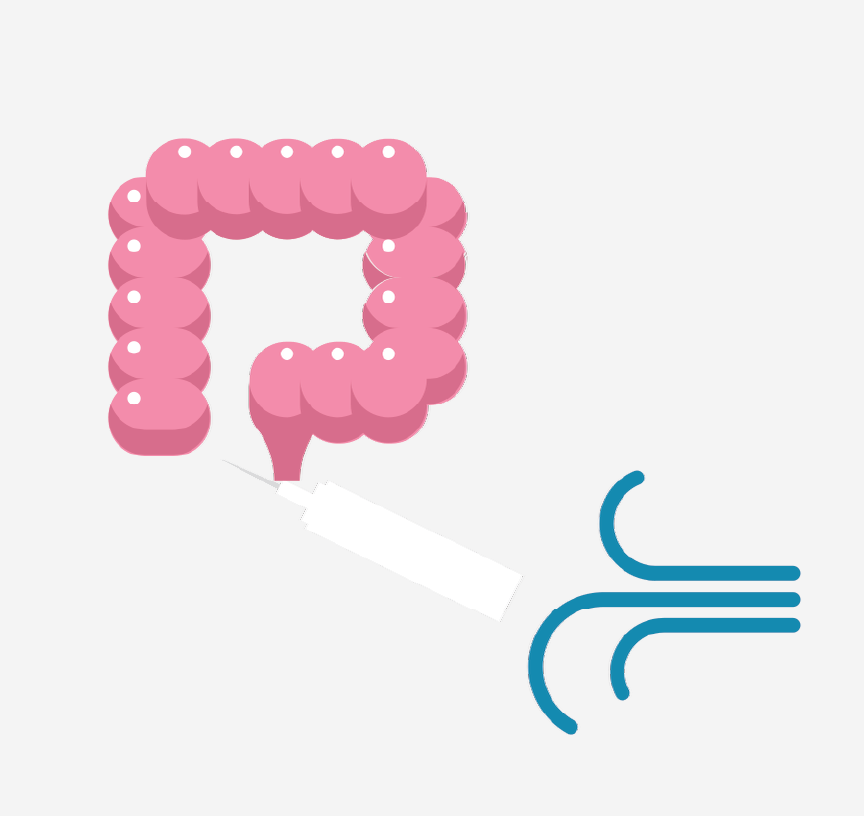 A graphic of a colon and a tube pumping air into it.