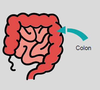 A diagram of the small and large intestine, with an arrow pointing to the colon, which is also called the large intestine.