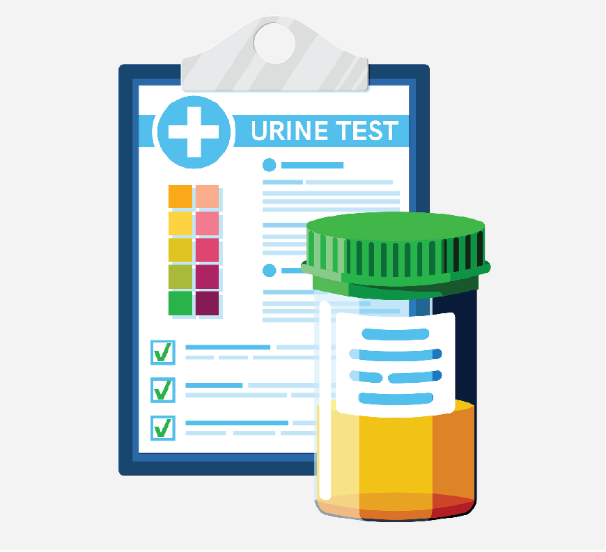 A clipboard with the words “urine test” written on it. There is also a urine specimen cup.