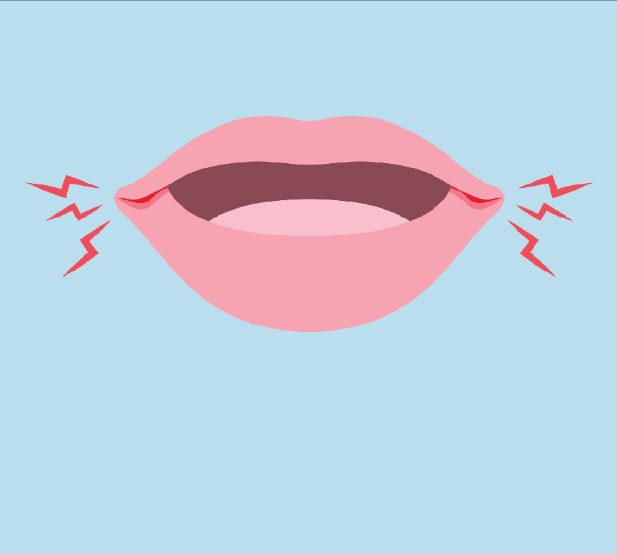 Cartoon of a mouth in pain.