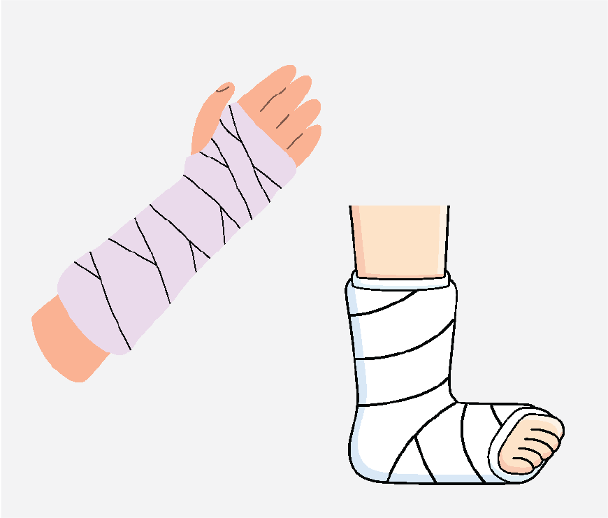 Graphic of an arm and leg, both have casts on them.