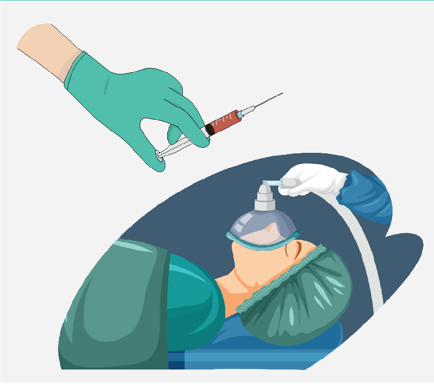 Graphic of a hand holding a needle and of a patient with a mask on. There are several ways to give the medicine for anesthesia.