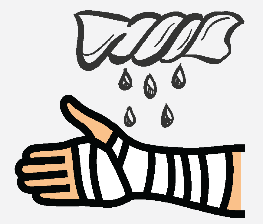 Graphic of an arm with cotton wrapped around it. Wet cast material is being wrapped around it.