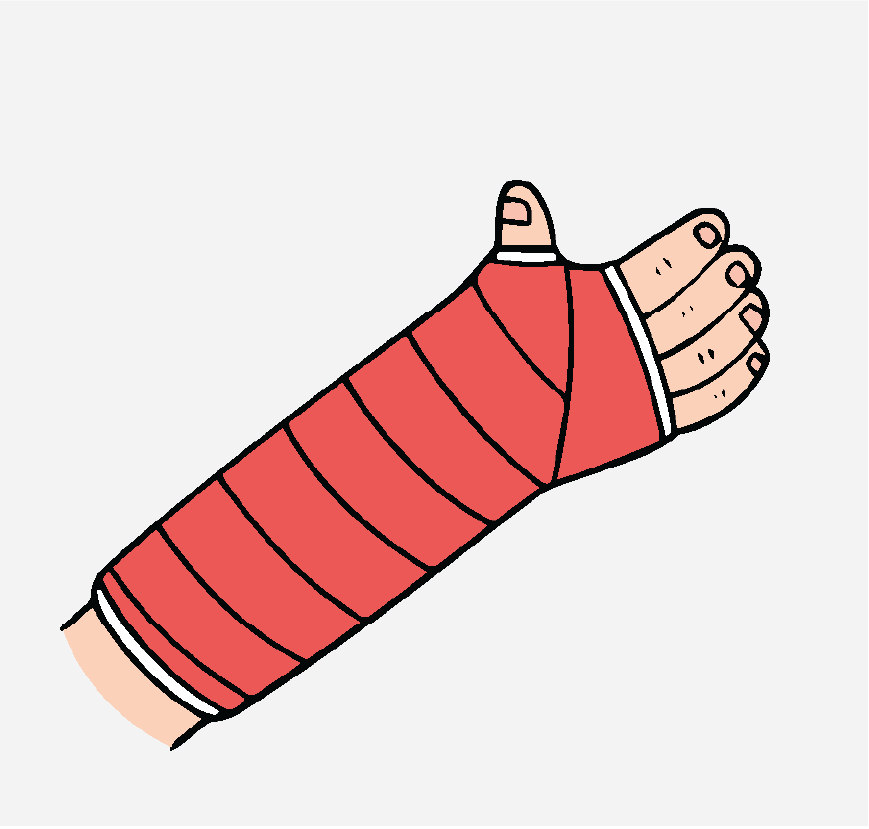 Graphic of an arm with a red cast on it.