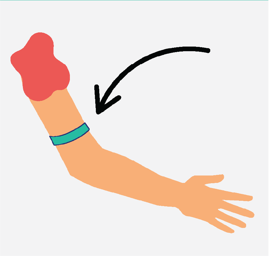 Graphic of an arm with a rubber band on the upper arm.